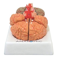 Cérebro Humano com Artérias em 9 pts Anatomia