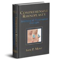Comprehensive rhinoplasty - Quality Medical Publishing